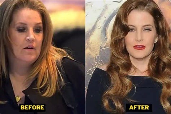 Brandon Presley Weight Loss: Check His Before And After Photos