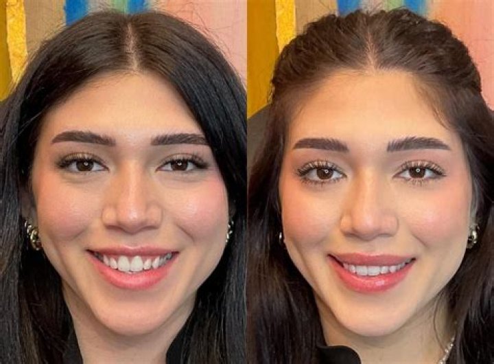 Is Sam Claflin Perfect Teeth Reason Behind His Pearly Smile? Before And After Pics