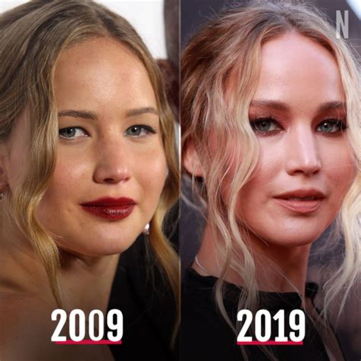 Jennifer Lawrence's Nose Job: Unveiling The Truth