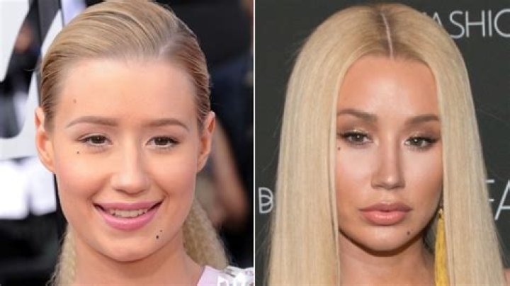 The Long List Of Celebs Who Have Gotten Nose Jobs (And What They Looked Like Before)